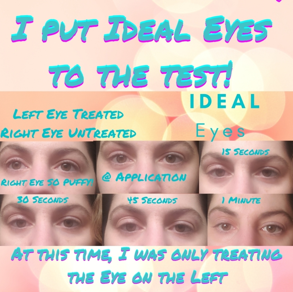 PREORDER ONLY Eye Bag, Dark Circles, Puffiness